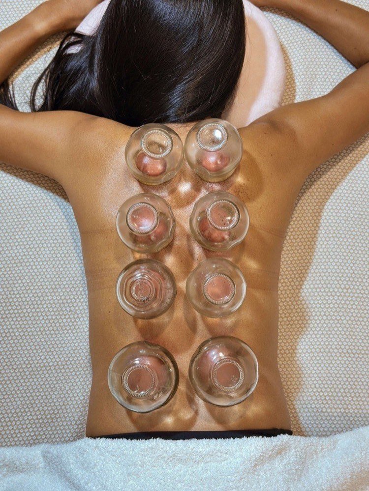 Cupping therapy overhead view